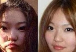 爆料小猪整容视频大全,整容前后对比视频大盘点
